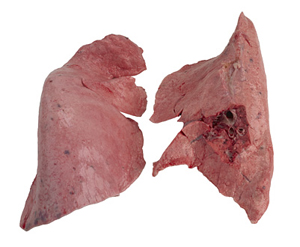 Lung Lobe